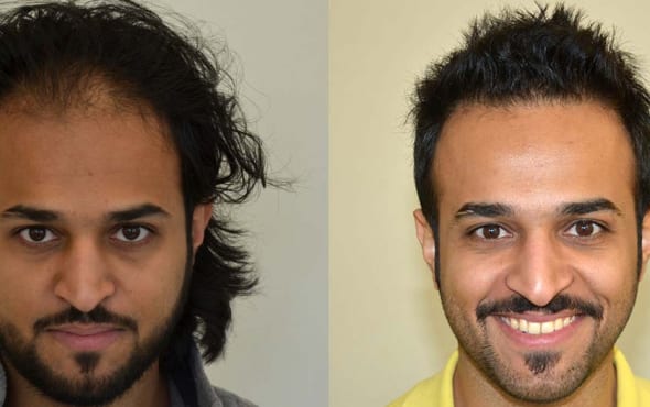 New Questions About Hair Care Products Answered And Why You Will Need To Read Every Word Of This Report