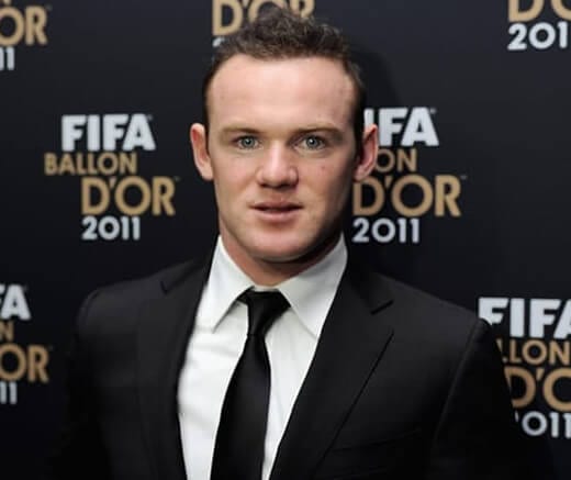 Wayne Rooney hair transplant