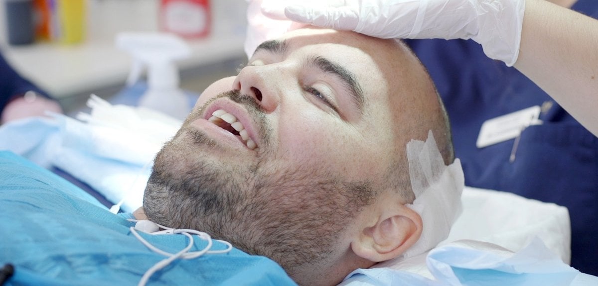 The Importance Of The Hairline In A Hair Transplant Procedure