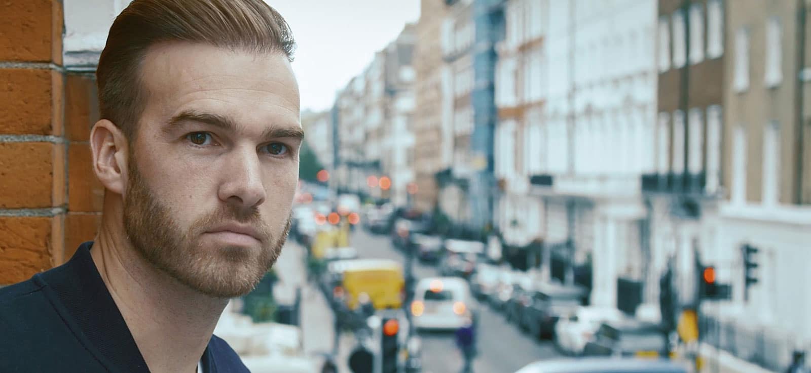 Harley street hair clinic hair transplant