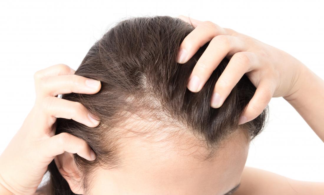 AAYNA Hair Loss Treatment  Hair Clinic Near Me