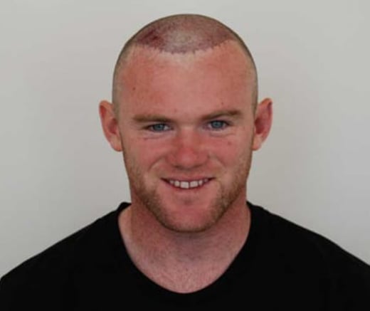 Wayne Rooney