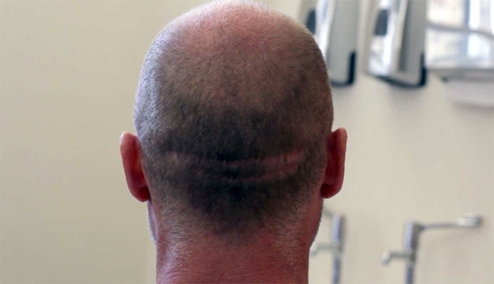 our treatments