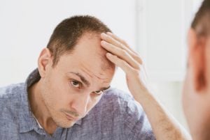 man worried about thinning hair