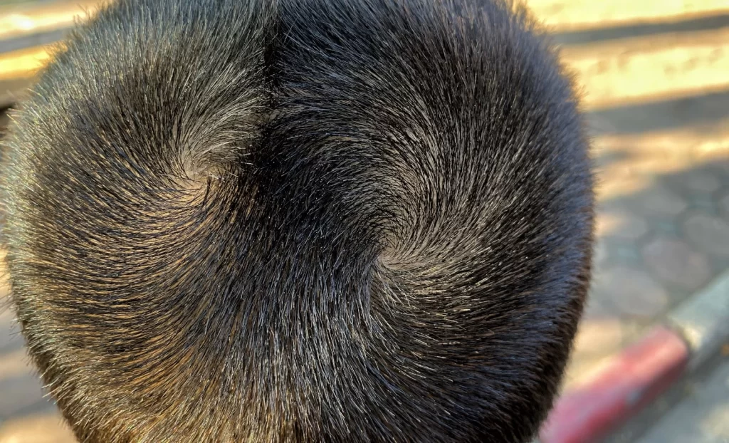 Double hair whorl