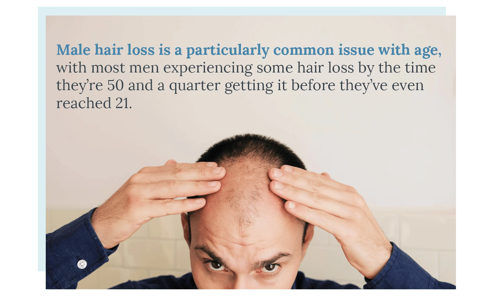 male hair loss