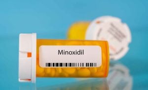 Minoxidil for women