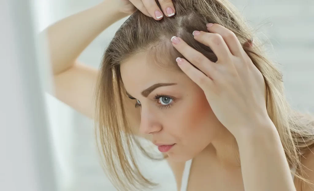 Thinning hair in women