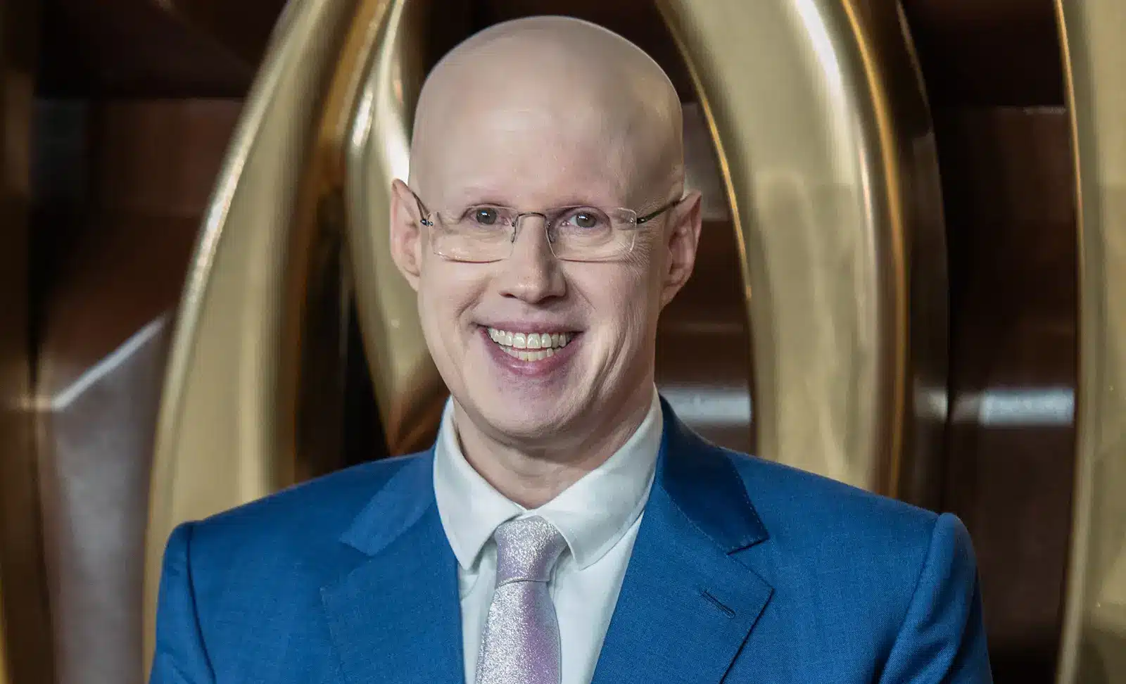 Matt Lucas 2023 hair loss