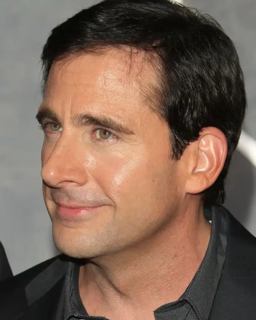 Steve Carell before hair transplant 2007