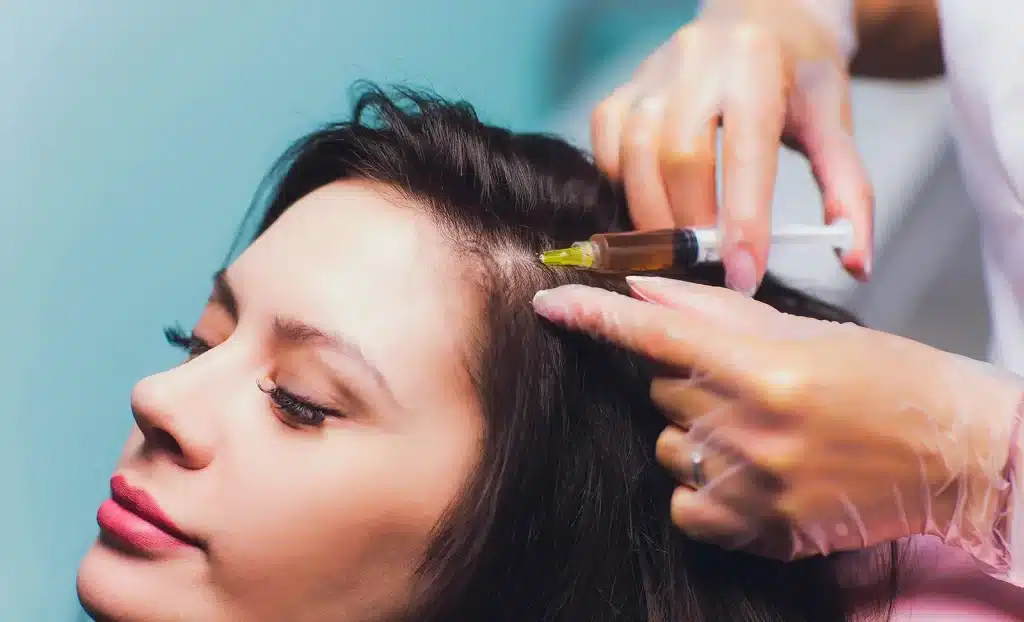 Plasma Injection for hair loss