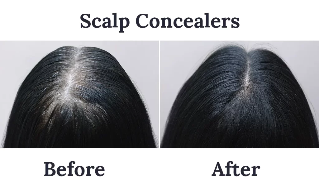 Scalp concelear before and after 