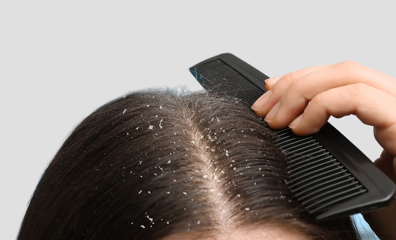 Scalp issues