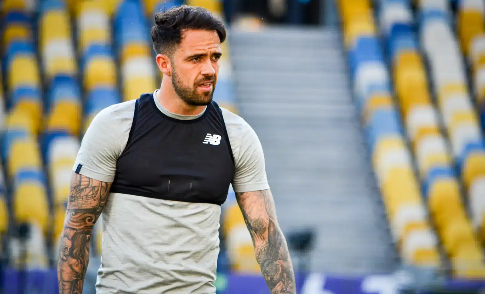 Danny Ings hair transplant