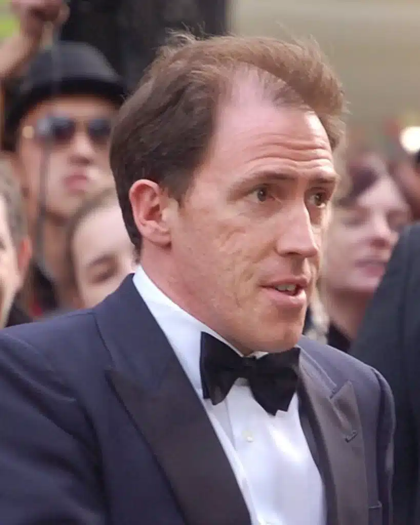 Rob Brydon hair loss 2008