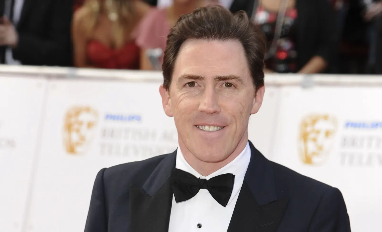 Rob Brydon hair transplant