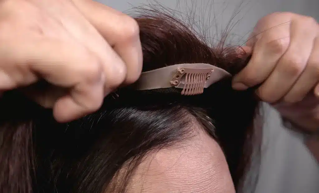 Wig application for temple hair loss 