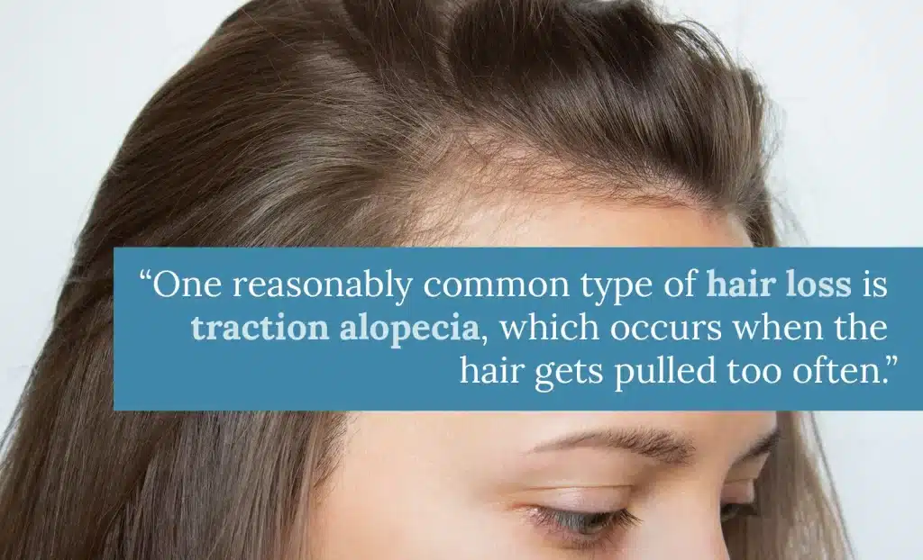 Receding hairline on women