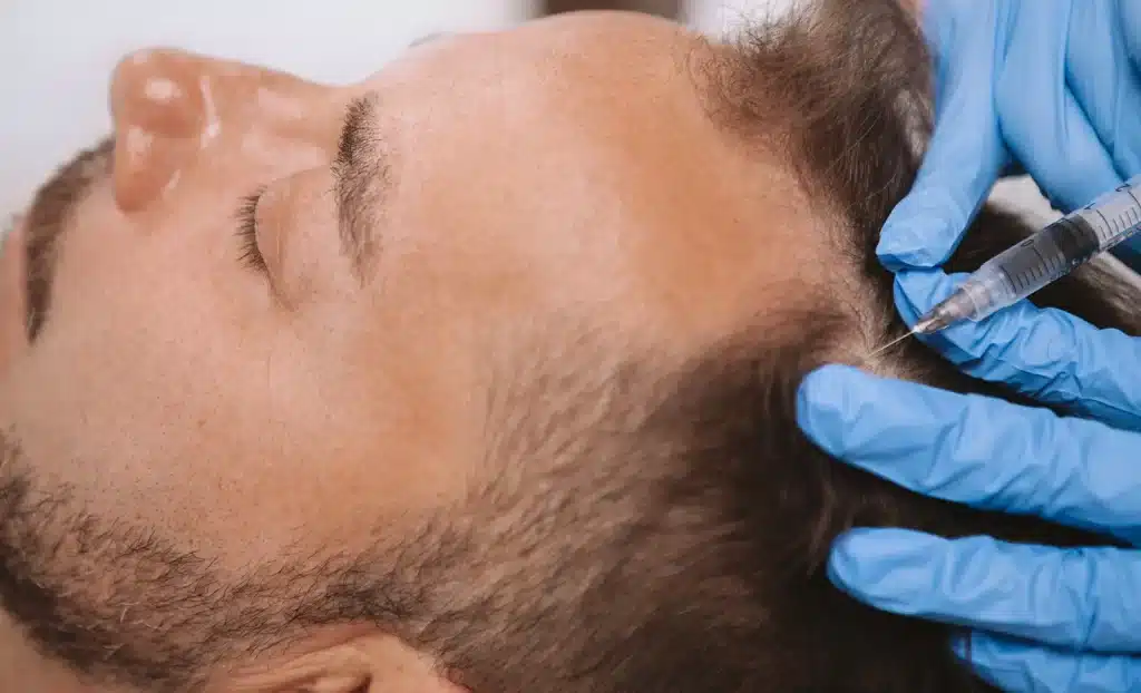 hair loss injections