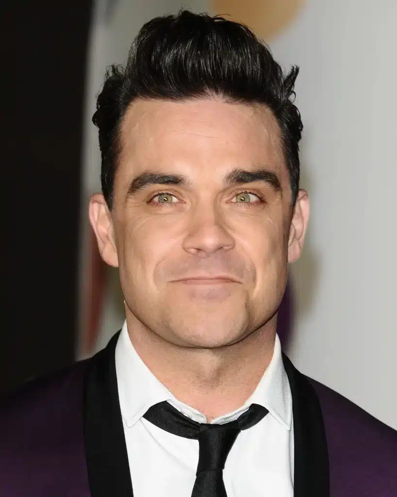 Robbie Williams - hair transplant 2013