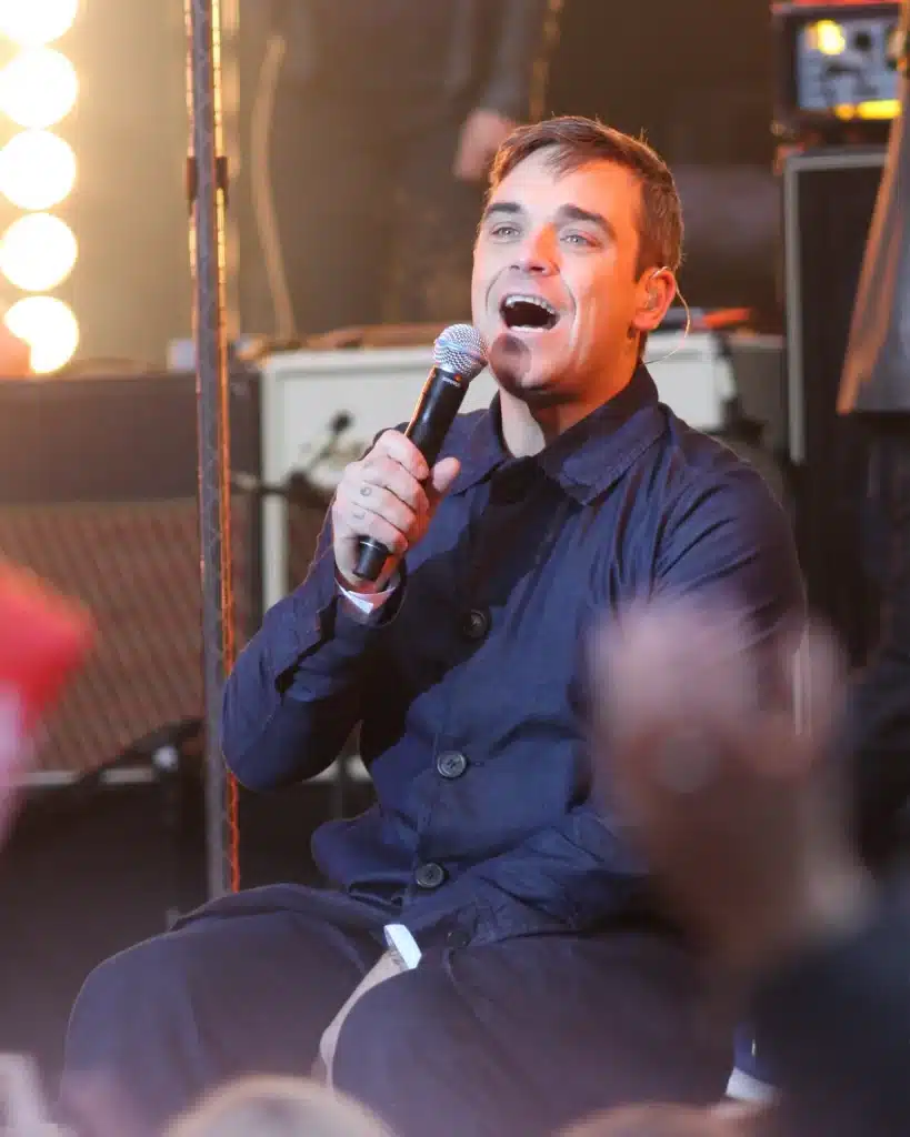Robbie Williams - before hair transplant2009