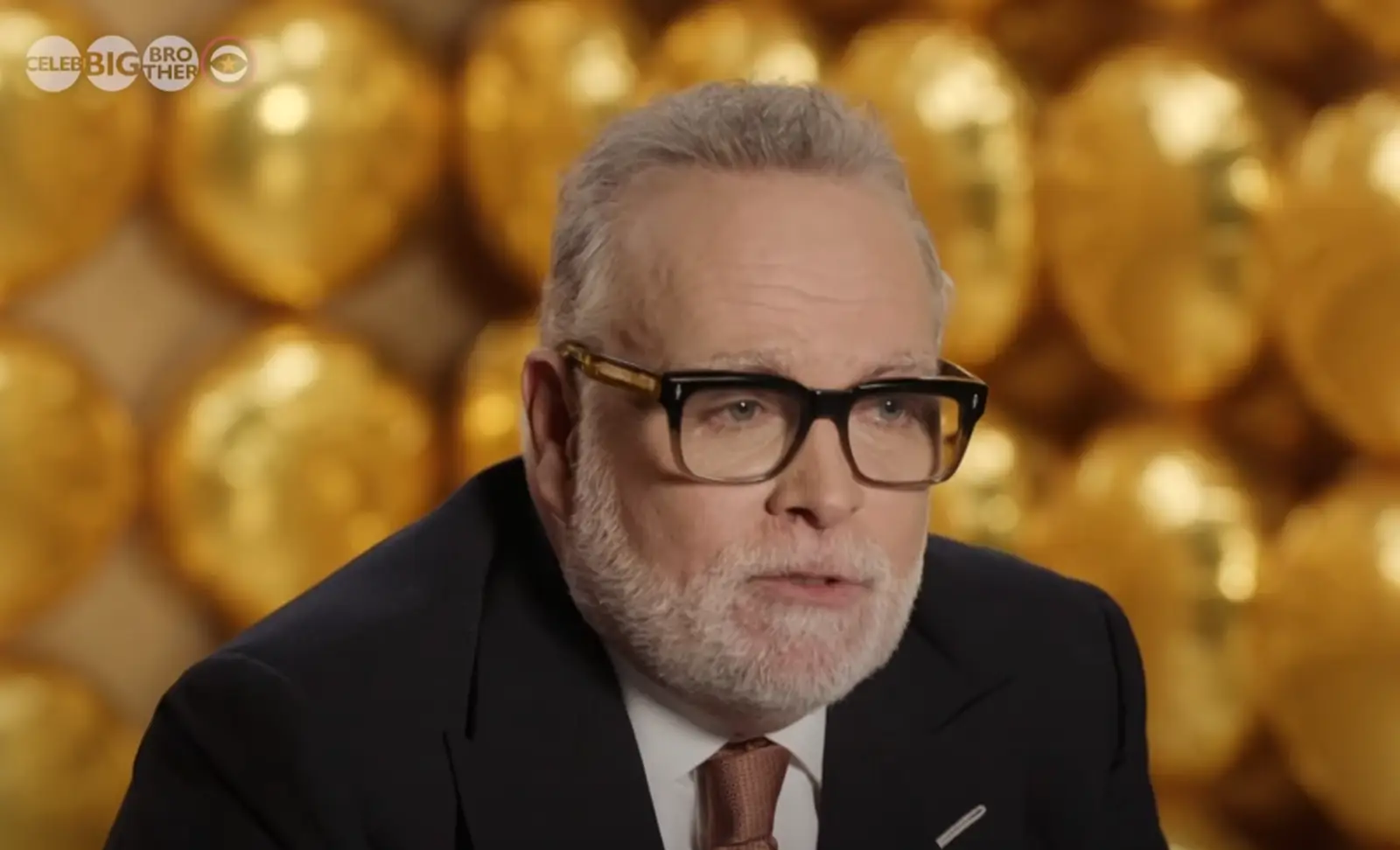 Gary Goldsmith post Hair Transplant