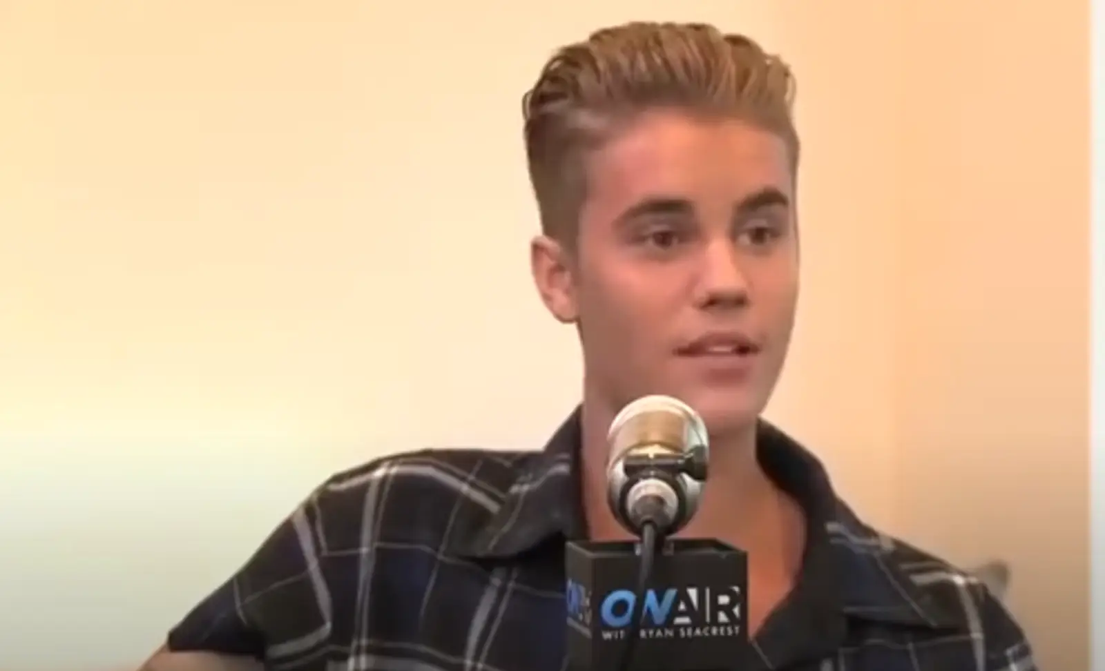 Justin Beiber hair loss
