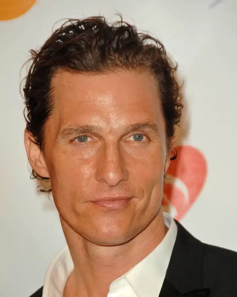 Matthew-McConaughey before hair transplant