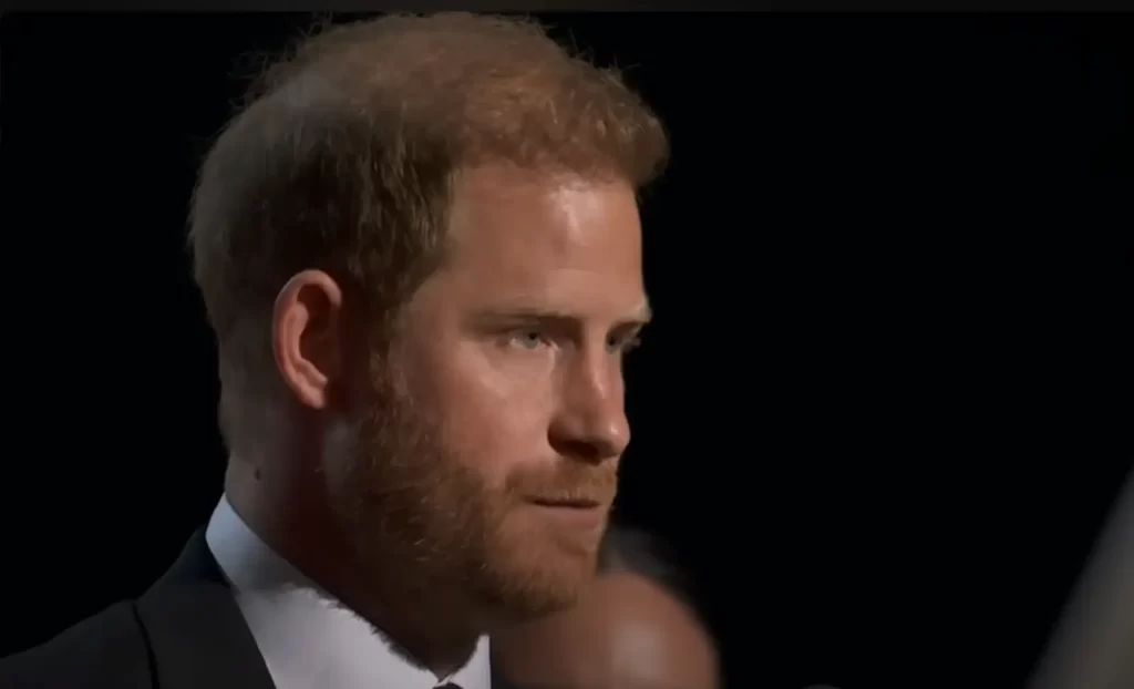 Did Prince Harry have a hair transplant