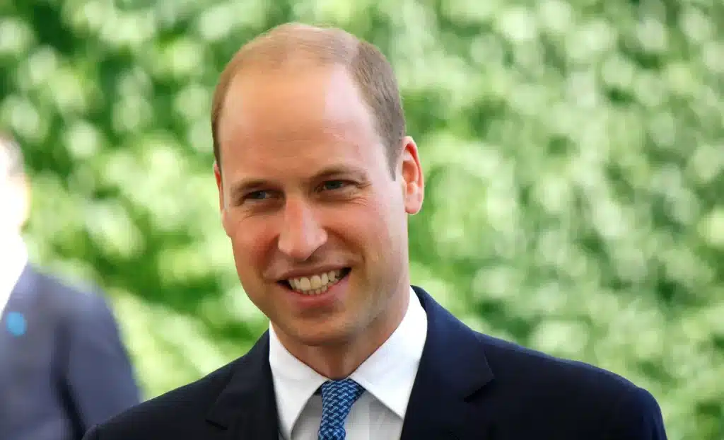 Prince William hair loss