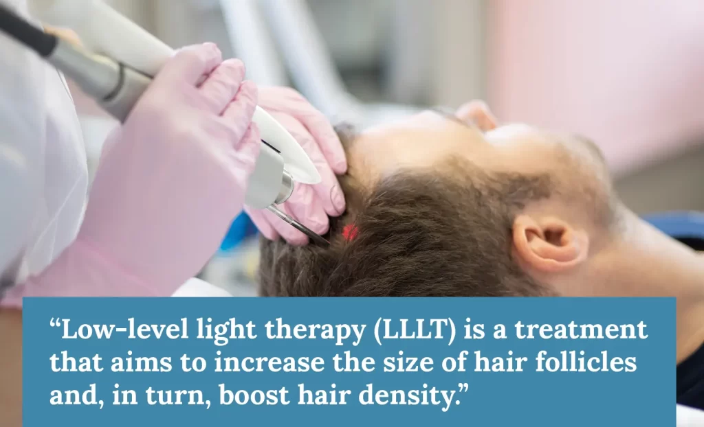 Low level light therapy for hair loss 