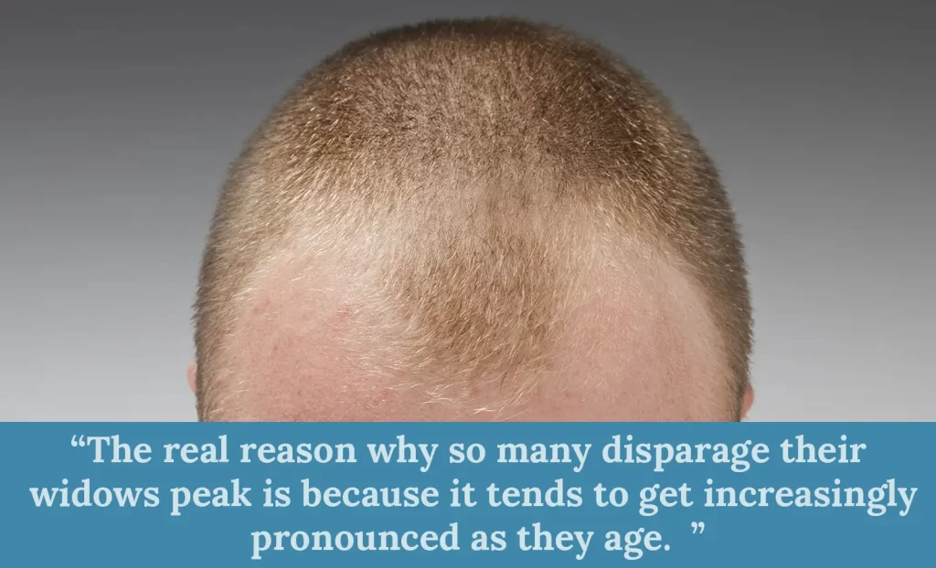 How does a widows peak change