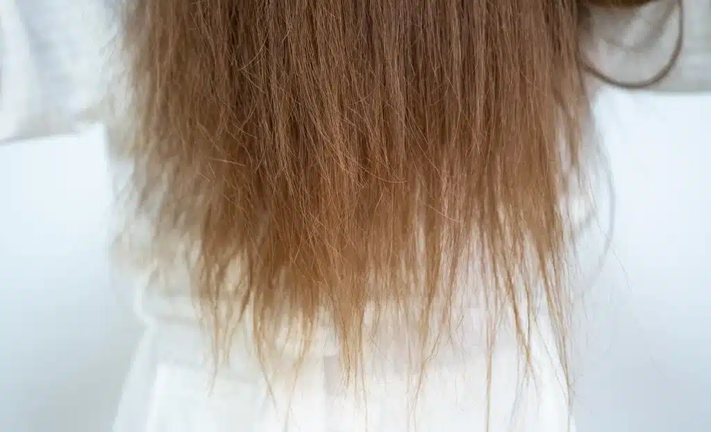 Damaged hair 
