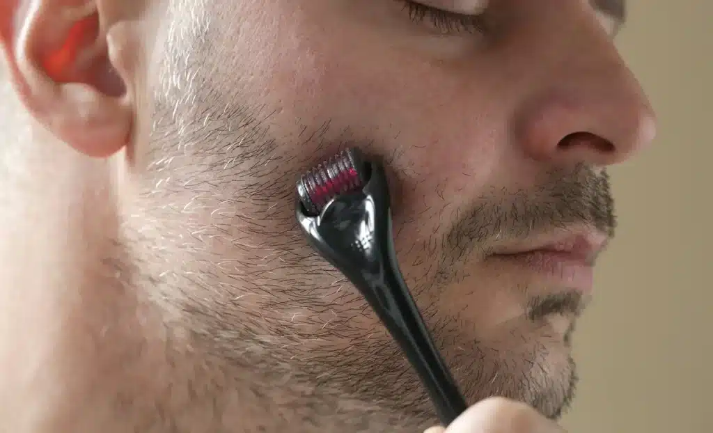 Derma Rolling for facial hair 