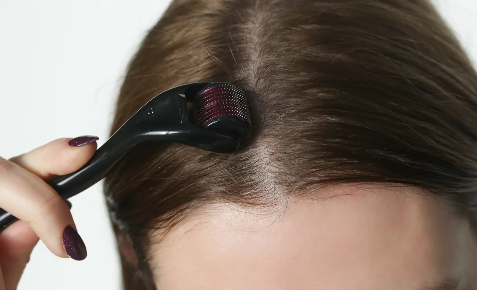 Derma Rolling and hair growth