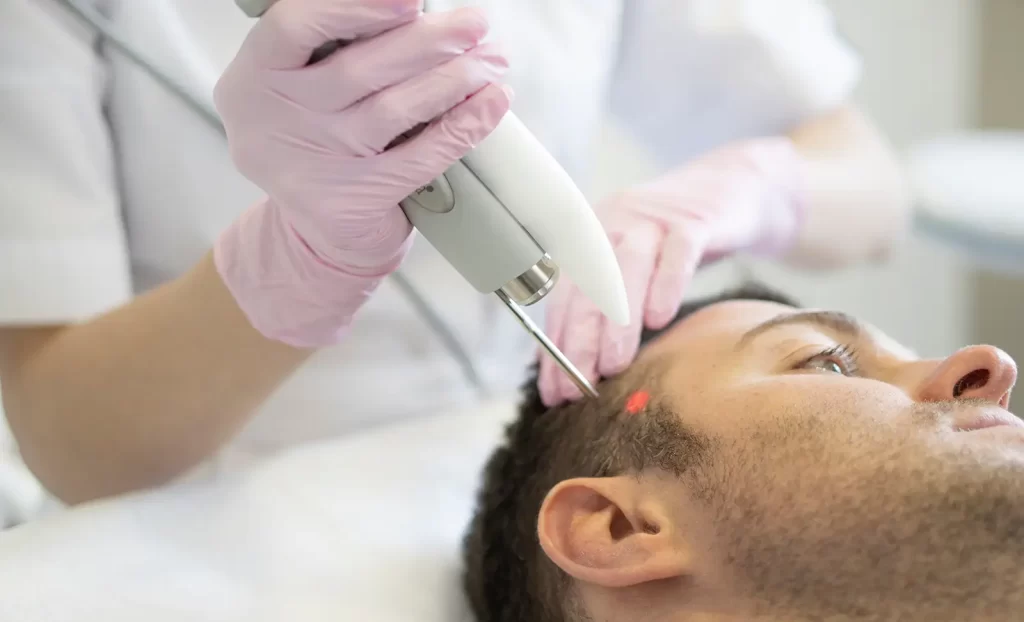Laser hair therapy  