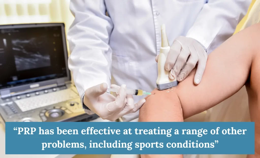 PRP treatment 