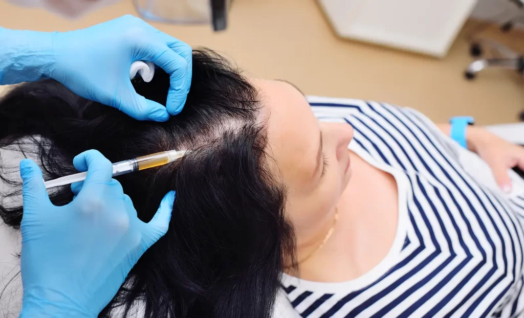 PRP for female hair loss 