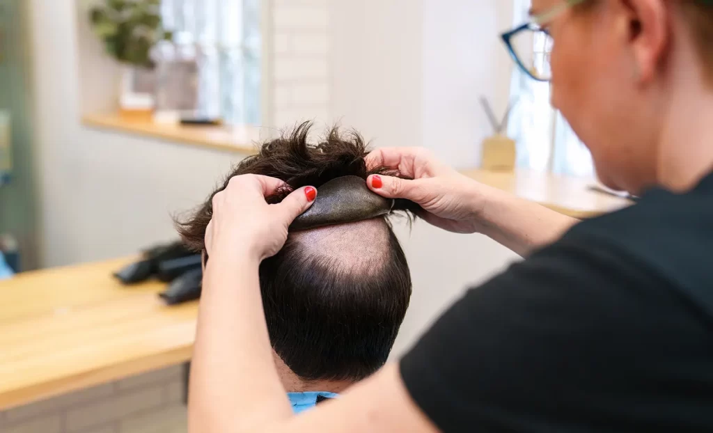 hair fitting for men