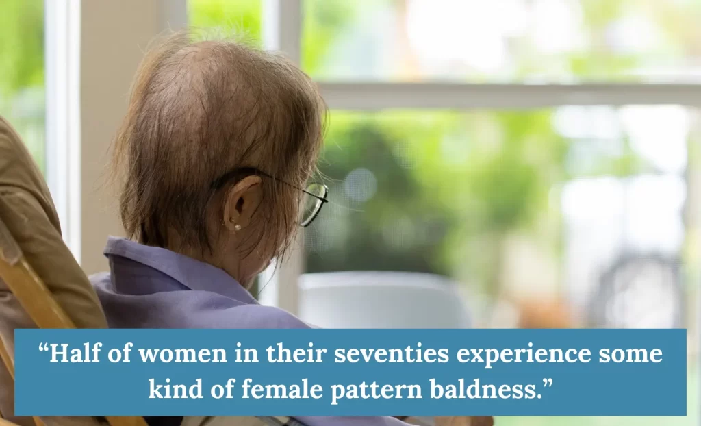 age related hair loss