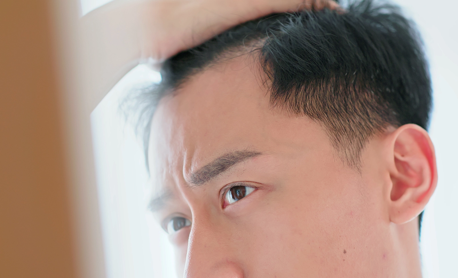 Uneven Hairlines