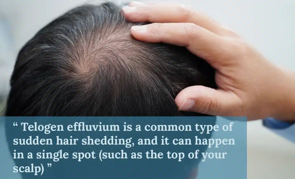 Amitriptyline and hair loss