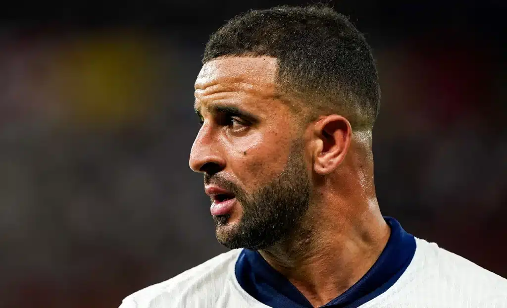 Kyle Walker Hair Transplant 2024