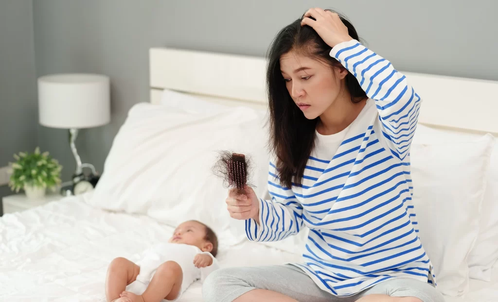 hair loss after child birth 