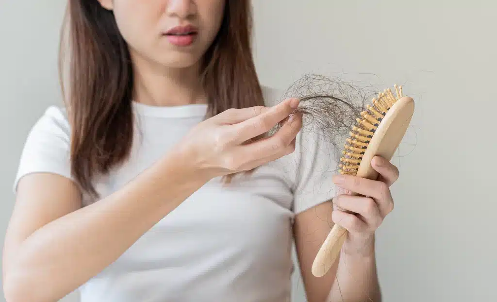 Guide to Telogen Effluvium