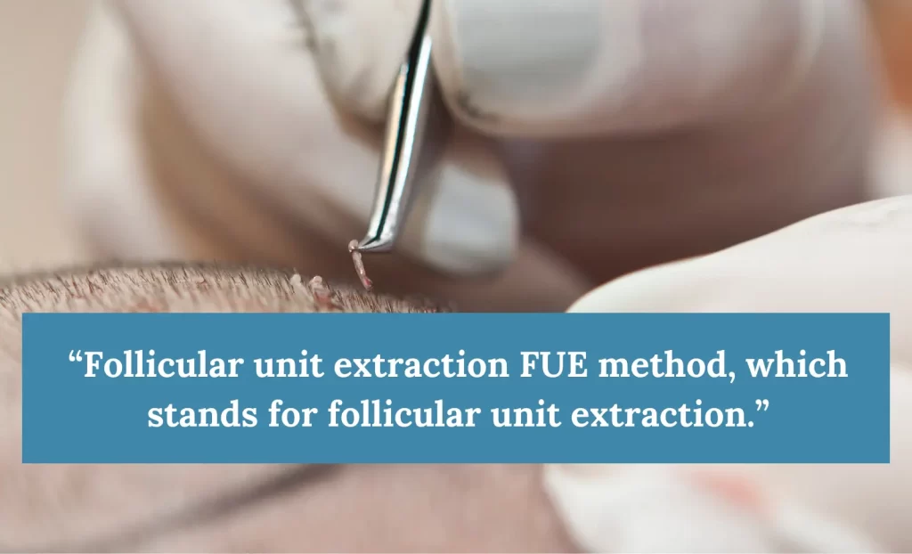 FUE hair transplant method  