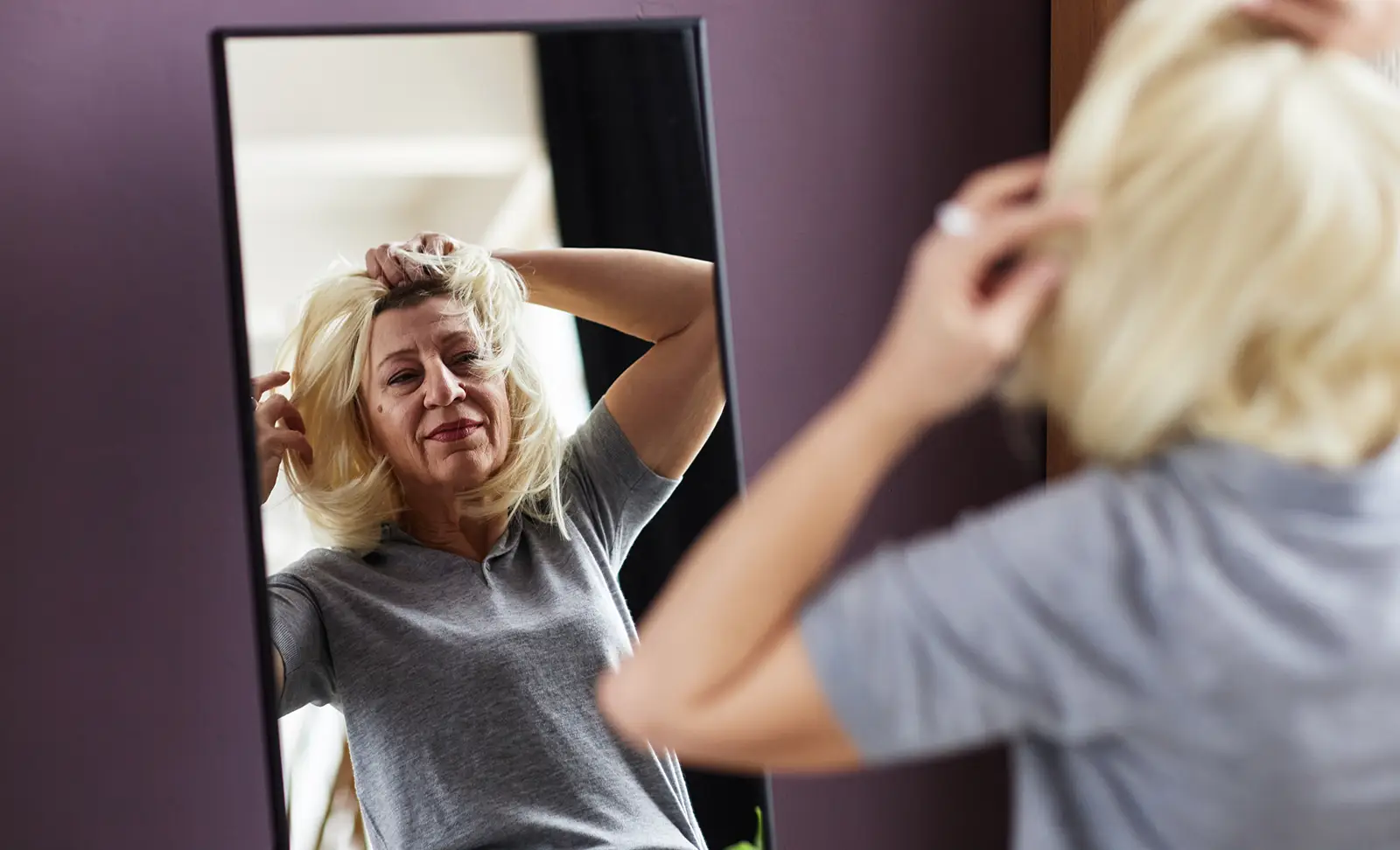 Scarring Alopecia