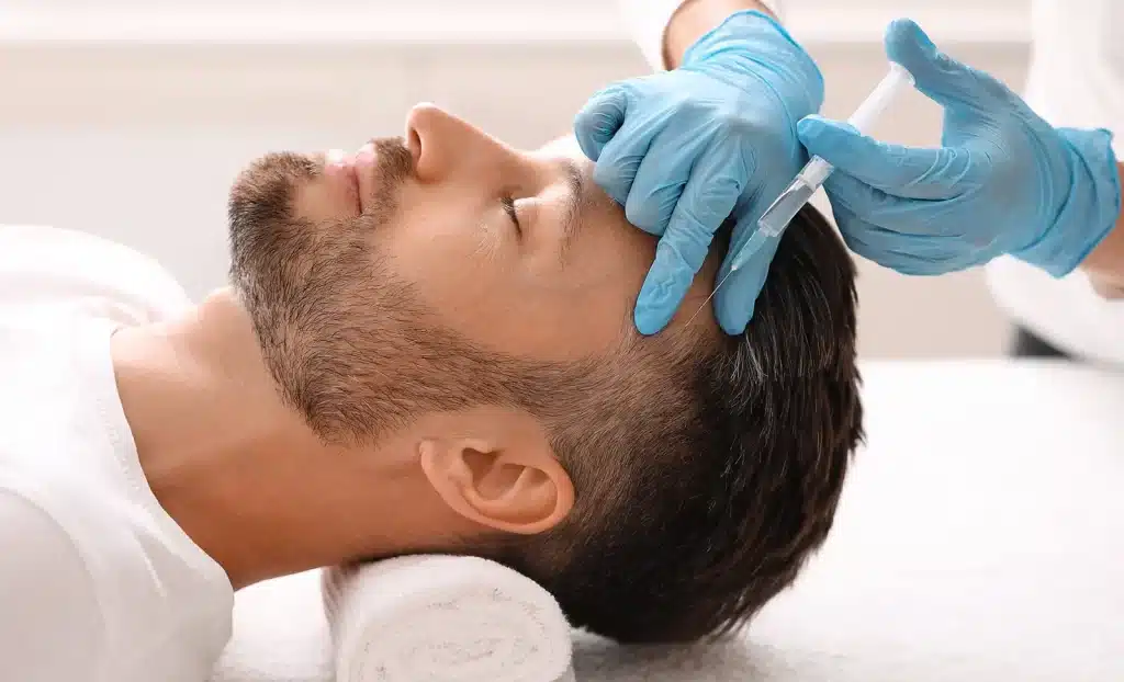 Scarring Alopecia steroid injection