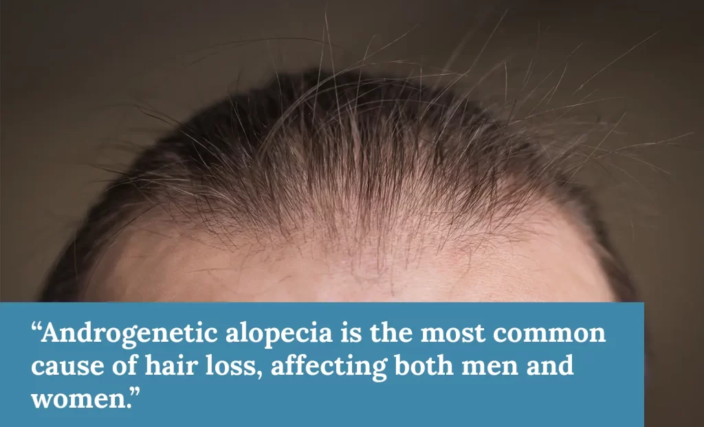 Protein and Hair loss