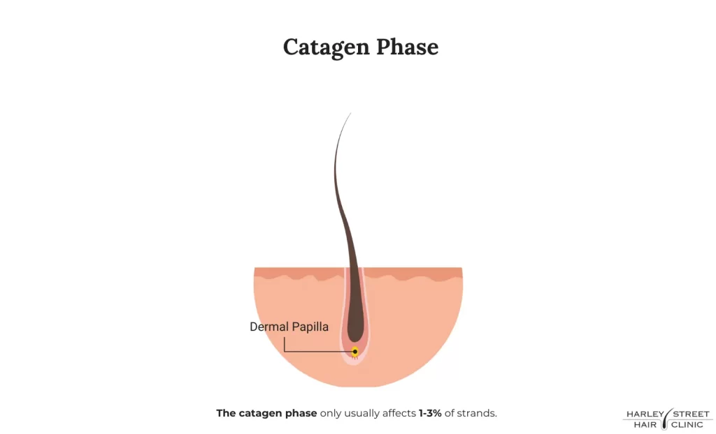 Hormones and Female Hair Loss
